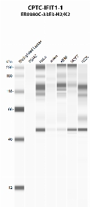 Click to enlarge image Automated western blot using CPTC-IFIT-1 as primary antibody against PBMC (lane 2), HeLa (lane 3), Jurkat (lane 4), A549 (lane 5), MCF7 (lane 6), and NCI-H226 (lane 7) whole cell lysates.  Expected molecular weight - 55.4 kDa and 51.7 kDa.  Molecular weight standards are also included (lane 1). All cell lines are presumed positive except for PBMC.