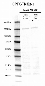 Click to enlarge image Western Blot usign CPTC-TNK2-3 as primary antibody against cell lysates of MDA-MB-231 cells treated (lane 2) and not treated (lane 3) with EGF (100 ng/mL0 for 10 minutes, after overnight starvation). Molecular weight standards are also included (lane 1). The antibody was able to detect  the not phosphorylated and phosphrylated target protein in the EGF treated and not treated cell lysate. Expected molecultar weight for TNK2 is about 114 KDa.