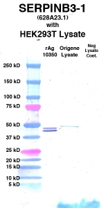Click to enlarge image Western Blot using CPTC-SERPINB3-1 as primary Ab against cell lysate from transiently overexpressed HEK293T cells form Origene (lane 3). Also included are molecular wt. standards (lane 1), lysate from non-transfected HEK293T cells as neg control (lane 4) and recombinant Ag SERPINB3 (NCI 10350) in (lane 2). 