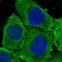 Click to enlarge image Results provided by the Human Protein Atlas (www.proteinatlas.org). The subcellular location is supported by literature. Immunofluorescent staining of human cell line A-431 shows localization to plasma membrane & cytosol. Human assay: A-431 fixed with PFA, dilution: 1:10
Human assay: U-2 OS fixed with PFA, dilution: 1:10