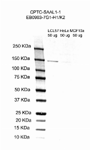 Click to enlarge image Western Blot using CPTC-SAAL1-1 as primary antibody against cell lysates LCL57 (lane 2), HeLa (lane 3) and MCF10A (lane 4). Also included are molecular weight standards (lane 1).