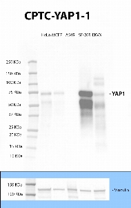 Click to enlarge image Western blot using CPTC-YAP1-1 as primary antibody against whole cell lysates of HeLa, MCF7, A549, SF-268 and EKVX. The target protein was detected in HeLa, MCF7, SF-268 and EKVX. The same cell lines were tested against an anti-vinculin antibody, and all the cell lines expressed the protein.