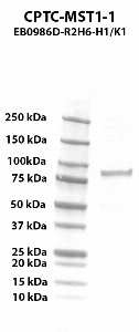 Click to enlarge image Western blot using CPTC-MST1-1 as primary antibody against human macrophage stimulating 1 (hepatocyte growth factor-like) (MST1) recombinant protein (lane 2).  Expected molecular weight - 78.4 kDa.  Molecular weight standards are also included (lane 1).