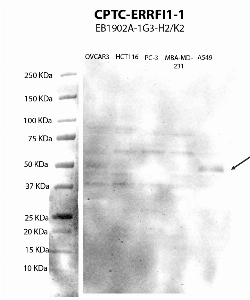 Click to enlarge image Western Blot using CPTC-ERFFI1-1 as primary antibody against cell lysates OVCAR3, HCT116, PC-3, MBA-MD-231 and A549 (lane 2) with expected MW of 50 KDa. Positive for A549 lysates, inconclusive/negative results for the other cell lysates. Molecular weight standards are also included (lane 1). ECL detection.