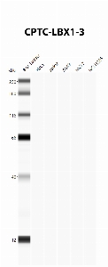 Click to enlarge image Automated Western Blot using CPTC-LBX1-3 as primary antibody against cell lysates A549, H226, HeLa, Jurkat and MCF7. Expected MW of 30.2 KDa. All cell lysates negative.  Molecular weight standards are also included (lane 1).