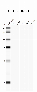 点击放大图像使用CPTC-LBX1-3作为针对细胞裂解物A549、H226、HeLa、Jurkat和MCF7的第一抗体的自动蛋白质印迹。预计MW为30.2 KDa。所有细胞裂解呈阴性。还包括分子量标准（车道1）。