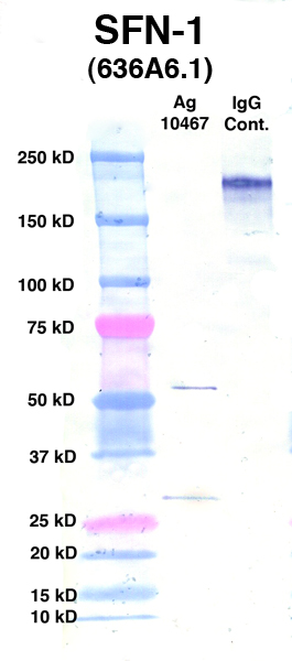Click to enlarge image Western Blot using CPTC-SFN-1 as primary Ab against Ag 10467 (lane 2). Also included are molecular wt. standards (lane 1) and mouse IgG control (lane 3).
