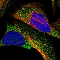 Click to enlarge image Results provided by the Human Protein Atlas (www.proteinatlas.org). The subcellular location is supported by literature. Immunofluorescent staining of human cell line U-2 OS shows localization to cytosol. 		

Human assay: A-431 fixed with PFA, dilution: 1:400
Human assay: U-2 OS fixed with PFA, dilution: 1:400
Human assay: U-251 MG fixed with PFA, dilution: 1:400