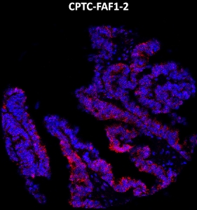 Click to enlarge image Imaging mass cytometry on ovarian cancer tissue core using CPTC-FAF1-2 metal-labeled antibody.  Data shows an overlay of the target protein signal (red) and DNA (blue). Dilution: 1:100 of 0.5mg/mL stock. Signal was also obtained in other normal tissues (colon, pancreas, lung testis, endometrium, appendix, and kidney) and cancer tissues (colon, breast, ovarian, lung, and prostate).