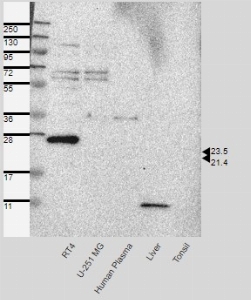 Click to enlarge image Results provided by the Human Protein Atlas (www.proteinatlas.org). Band of predicted size in kDa (+/-20%) with additional bands present. Analysis performed using a standard panel of samples. Antibody dilution: 1:500.