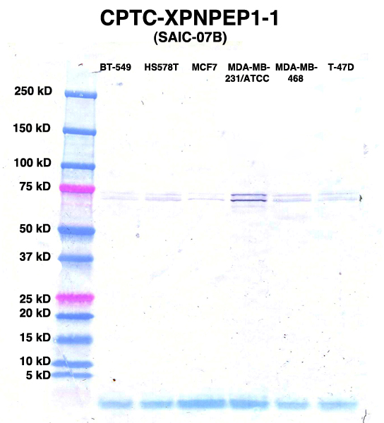 Click to enlarge image Western Blot using CPTC-XPNPEP1-1 as primary Ab against lysates from six breast cancer cell lines from the NCI60 cell line collection (lanes 2-7). Also included are molecular wt. standards (lane 1).