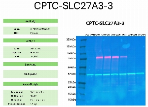 Click to enlarge image Western blot using CPTC-SLC27A3-3 as primary antibody against the whole lysates of U-87, MALME-3M, UACC-257, SK-MEL-28, MCF7, CCRF-CEM, and OVCAR-8. The antibody detected the target protein (~73.5 KDa) in MALME-3M, UACC-257, SK-MEL-28, and MCF7 cell lysates.