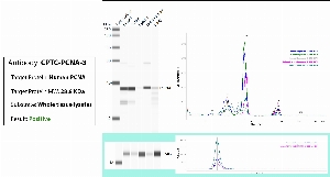 Click to enlarge image Automated WB (Simple Western) using CPTC-PCNA-3 as primary antibody against the whole lysate of breast, ovary, spleen, endometrium and lung tissues. Expected MW is 65 Kda. The antibody recognizes the target in the endometrium lysate and presuambly recognizes the target in the other tested lysates. The same cell lysates were probed with an anti-CytC antibody (bottom panel).