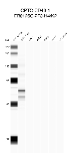 Click to enlarge image Automated western blot using CPTC-CD40-1 as primary antibody against buffy coat (lane 2), HeLa (lane 3), Jurkat (lane 4), A549 (lane 5), MCF7 (lane 6), and H226 (lane 7) whole cell lysates.  Expected molecular weight - 29.3.  Buffy coat is positive. All cell lines are negative. Molecular weight standards are also included (lane 1).