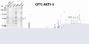 Click to enlarge image Automated western blot using CPTC-AKT1-5 as primary antibody against whole lysates of cell lines cell MDA-MB-231, HT-29, MCF7, T47D, SK-OV-3, and HeLa. The antibody cannot recognize the target in the cell lysates.