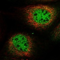 Click to enlarge image Results provided by the Human Protein Atlas (www.proteinatlas.org). The subcellular location is supported by literature. Immunofluorescent staining of human cell line A-431 shows localization to nucleoplasm & cytosol. 
Human assay: A-431 fixed with PFA, dilution: 1:2000
Human assay: U-2 OS fixed with PFA, dilution: 1:2000
Human assay: U-251 MG fixed with PFA, dilution: 1:2000