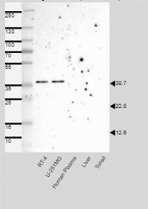 Click to enlarge image Results provided by the Human Protein Atlas (www.proteinatlas.org).

Single band corresponding to the predicted size in kDa (+/-20%).
Analysis performed using a standard panel of samples. Antibody dilution: 1:500