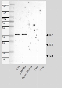 Click to enlarge image Results provided by the Human Protein Atlas (www.proteinatlas.org).

Single band corresponding to the predicted size in kDa (+/-20%).
Analysis performed using a standard panel of samples. Antibody dilution: 1:500