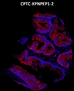 Click to enlarge image Imaging mass cytometry on colon cancer tissue core using CPTC-XPNPEP1-2 metal-labeled antibody.  Data shows an overlay of the target protein signal (red) and DNA (blue). Dilution: 1:100 of 0.5mg/mL stock. Signal was also obtained in other normal tissues (testis, prostate, liver, colon, endometrium, appendix, pancreas, bone marrow, breast, kidney, lung, and placenta) and cancer tissues (breast, lung, prostate, colon and ovarian).