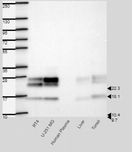 Click to enlarge image Results provided by the Human Protein Atlas (www.proteinatlas.org). Band of predicted size in kDa (+/-20%) with additional bands present. Analysis performed using a standard panel of samples. 
Band of predicted size in kDa (+/-20%) with additional bands present.
Analysis performed using a standard panel of samples.