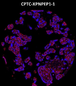 Click to enlarge image Imaging mass cytometry on normal placenta tissue core using CPTC-XPNPEP-1 metal-labeled antibody.  Data shows overlay of target protein signal (red) and DNA (blue). Dilution: 1:100 of 0.5mg/mL stock. Signal was also obtained in other normal tissues (testis, prostate, liver, colon, endometrium, appendix, pancreas, bone marrow, breast, kidney, lung, and placenta) and cancer tissues (breast, colon, prostate, lung, and ovarian).