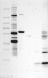 Click to enlarge image Results provided by the Human Protein Atlas (www.proteinatlas.org). Band of predicted size in kDa (+/-20%) with additional bands present.
Analysis performed using a standard panel of samples. Antibody Dilution 1:500