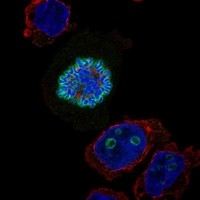 Click to enlarge image Results provided by the Human Protein Atlas (www.proteinatlas.org). The subcellular location is supported by literature. Immunofluorescent staining of human cell line THP-1 shows localization to nucleoli rim & mitotic chromosome. 		
Human assay: THP-1 fixed with PFA, dilution: 1:200
Human assay: U2OS fixed with PFA, dilution: 1:200