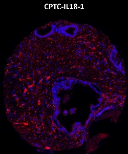 Click to enlarge image Imaging mass cytometry on normal prostate tissue core using CPTC-IL18-1 metal-labeled antibody.  Data shows an overlay of the target protein signal (red) and DNA (blue). Dilution: 1:100 of 0.5mg/mL stock. Signal was also obtained in other normal tissues (testis, liver, colon, endometrium, appendix, bone marrow, breast, kidney, lung, and placenta) and cancer tissues (breast, colon, prostate, lung, and ovarian).