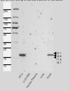 Click to enlarge image Single band corresponding to the predicted size in kDa (+/-20%).
Analysis performed using a standard panel of samples. Antibody dilution: 1:500