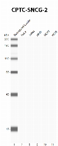 Click to enlarge image Automated Western Blot using CPTC-SNCG-2 as primary Ab against cell lysate from HeLa, Jurkat, A549, MCF7 and H226 cells (lane 2-6). Also included are molecular wt. standards (lane 1). Expected MW is 13 KDa. Colorimetric detection. Negative for all cell lines.