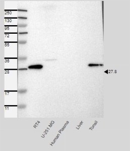 Click to enlarge image Results provided by the Human Protein Atlas (www.proteinatlas.org). Band of predicted size in kDa (+/-20%) with additional bands present. Analysis performed using a standard panel of samples. Antibody dilution: 1:250.