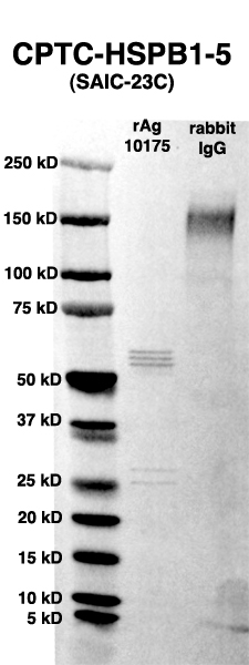 Click to enlarge image Western Blot using CPTC-HSPB1-5 as primary Ab against full-length recombinant Ag 10175 (lane 2). Also included are molecular wt. standards (lane 1) and the SNCG-3 Ab as positive control (lane 3).