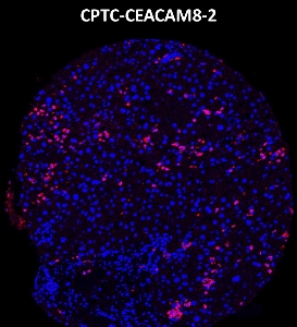 Click to enlarge image Imaging mass cytometry on normal liver tissue core using CPTC-CEACAM8-2 metal-labeled antibody.  Data shows overlay of target protein signal (red) and DNA (blue). Dilution: 1:100 of 0.5mg/mL stock. Signal was also obtained in other normal tissues (liver, colon, endometrium, appendix, pancreas, bone marrow, breast, kidney, lung, and placenta) and cancer tissues (breast, colon, prostate, lung, and ovarian).