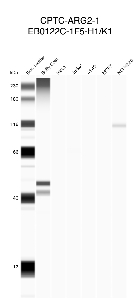Click to enlarge image Automated western blot using CPTC-ARG2-1 as primary antibody against buffy coat (lane 2), HeLa (lane 3), Jurkat (lane 4), A549 (lane 5), MCF7 (lane 6), and H226 (lane 7) whole cell lysates.  Expected molecular weight - 38.6. Buffy coat is positive. All cell lines are negative. Molecular weight standards are also included (lane 1).