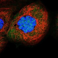 Click to enlarge image Results provided by the Human Protein Atlas (www.proteinatlas.org).  The subcellular location is partly supported by literature or no literature is available. Immunofluorescent staining of human cell line A-431 shows localization to nucleoplasm & cytosol.  Human assay: A-431 fixed with PFA, dilution: 1:2000