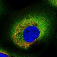 Click to enlarge image Results provided by the Human Protein Atlas (www.proteinatlas.org). The subcellular location is supported by literature. Immunofluorescent staining of human cell line A-431 shows localization to plasma membrane & cytosol. Human assay: A-431 fixed with PFA, dilution: 1:75
Human assay: U-2 OS fixed with PFA, dilution: 1:75
Human assay: U-251 MG fixed with PFA, dilution: 1:75