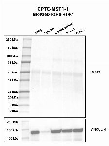 Click to enlarge image Western blot using CPTC-MST1-1 as primary antibody against human lung (2), spleen (3), endometrium (4), breast (5), and ovary (6) tissue lysates. The expected molecular weight is 55.6 kDa and 52.3 kDa. Vinculin was used as a loading control.