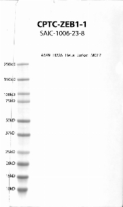 Click to enlarge image Western Blot using CPTC-ZEB1-1 as primary antibody against cell lysates A549, H226, HeLa, Jurkat and MCF7. Expected MW of 124 KDa. All cell lysates negative.  Molecular weight standards are also included (lane 1).