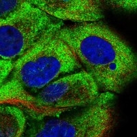 Click to enlarge image Results provided by the Human Protein Atlas (www.proteinatlas.org). The subcellular location is supported by literature. Immunofluorescent staining of human cell line A-431 shows localization to cytosol. 	

Human assay: A-431 fixed with PFA, dilution: 1:20
Human assay: U-2 OS fixed with PFA, dilution: 1:20
Human assay: U-251 MG fixed with PFA, dilution: 1:20