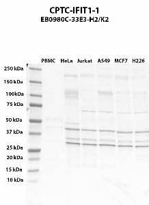 Click to enlarge image Western blot using CPTC-IFIT1-1 as primary antibody against PBMC (lane 2), HeLa (lane 3), Jurkat (lane 4), A549 (lane 5), MCF7 (lane 6), and NCI-H226 (lane 7) whole cell lysates.  Expected molecular weight - 55.4 kDa and 51.7 kDa.  Molecular weight standards are also included (lane 1). HeLa is presumed positive. All other cell lines are negative.
