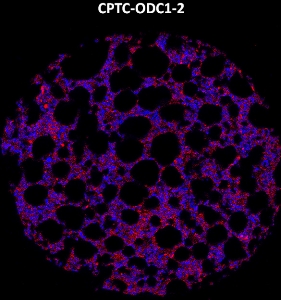 Click to enlarge image Imaging mass cytometry on bone marrow core using CPTC-ODC1-2 metal-labeled antibody.  Data shows an overlay of the target protein signal (red) and DNA (blue). Dilution: 1:100 of 0.5mg/mL stock. Signal was also obtained in other normal tissues (liver, bone marrow, spleen, colon, pancreas, breast, lung, endometrium, and kidney) and cancer tissues (breast, colon, ovarian, and lung).