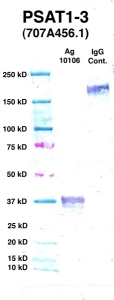 Click to enlarge image Western Blot using CPTC-PSAT1-3 as primary Ab against PSAT1 (Ag 10106) (lane 2). Also included are molecular wt. standards (lane 1) and mouse IgG control (lane 3).
