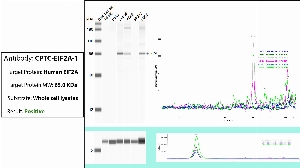 Click to enlarge image Automated WB (Simple Western) using CPTC-EIF2A-1 as primary antibody against the whole lysate of PBMC, HeLa, Jurkat, A549, MCF7 and H226. Expected MW is 65 KDa. The antibody recognizes the target in Jurkat, A549 adn H226 lysates. The same cell lysates were probed with an anti-CytC antibody (bottom panel).