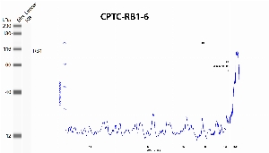Click to enlarge image Automated western blot using CPTC-RB1-6 as primary antibody against recombinant RB1 protein. Protein molecular weight is about 108 KDa.
