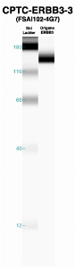 Click to enlarge image Western Blot using CPTC-ERBB3-3 as primary Ab against recombinant ERBB3 (lane 2). Also included are molecular wt. standards (lane 1).