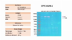 Click to enlarge image Western blot using CPTC-EGFR-2 as primary antibody against the whole cell lysates of A498, ACHN, H226, H322M, CCRF-CEM and HL-60. The antibody is able to detect the target protein in the cell lines A498, ACHN, H226 and H322M. Expected MW is 134 KDa. The same membrane was probed with an anti-Vinculin antibody. Vinculin was detected in  A498, ACHN, H226 and H322M, and weakly in CCRF-CEM and HL-60.