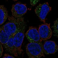 Click to enlarge image This PDF contains the evaluation results provided by the Human Protein Atlas (www.proteinatlas.org). The subcellular location is supported by literature. Immunofluorescent staining of human cell line THP-1 shows localization to cytosol. Human assay: THP-1 fixed with PFA, dilution: 1:100
Human assay: U2OS fixed with PFA, dilution: 1:100