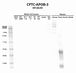 Click to enlarge image Western blot using CPTC-APOB-3 as primary antibody against COLO205 (lane 2), HCC-2998 (lane 3), HCT-116 (lane 4), HCT-15 (lane 5), HT-29 (lane 6), SW-620 (lane 7), CaCO2 (lane 8), Hep G2 (lane 9) whole cell lysates and human (lane 10), mouse (lane 11), bovine (lane 12), and rabbit (lane 13) plasma. Expected molecular weight – 516 kDa.  Molecular weight standards are also included (lane 1).  Hep G2 and human plasma are positive.