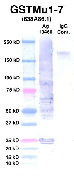 点击放大图像Western Blot，使用CPTC-GSTMu1-7作为Ag 10460的主要抗体（通道2）。还包括分子重量标准（通道1）和小鼠IgG控制（通道3）。