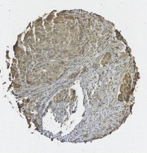 Click to enlarge image Tissue Microarray core immunohistochemically stained with antibody CPTC-PTEN-7